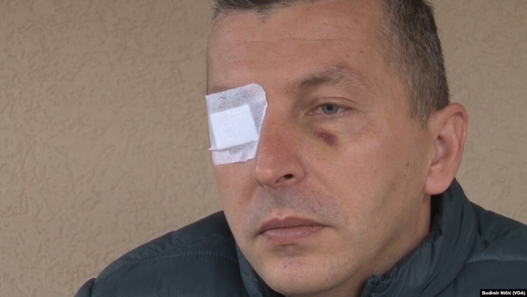 Ivan Vasić je pre četiri meseca izgubio vid posle konzumiranja domaće rakije sa velikim udelom metil alkohola.